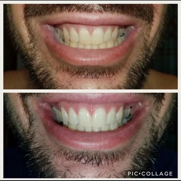 Toothpaste - Picture 2 of 7